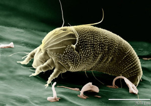 How to Deal with Dust Mite Allergies